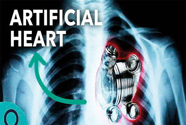 artifical-heart